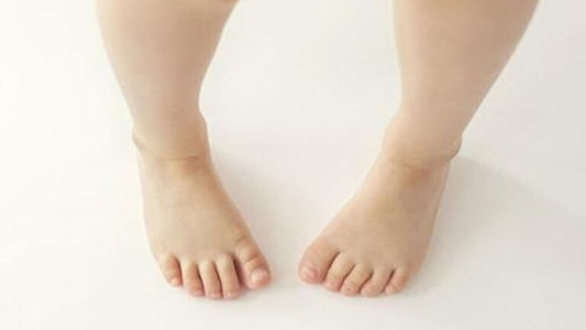 Understanding Intoeing Gait in Children: What Parents Should Know