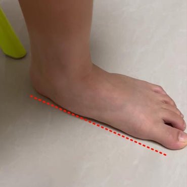 Understanding Flat Feet in Children: How Corrective Shoes Can Make a Difference - Princepard